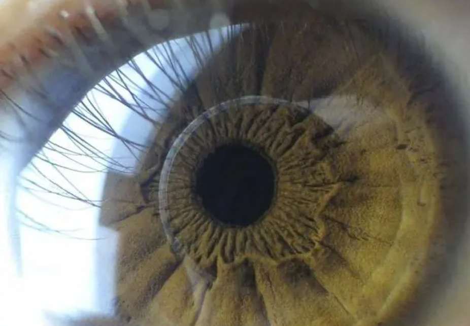 研究員將VR頭顯用于眼科，實現精確的瞳孔患病檢查