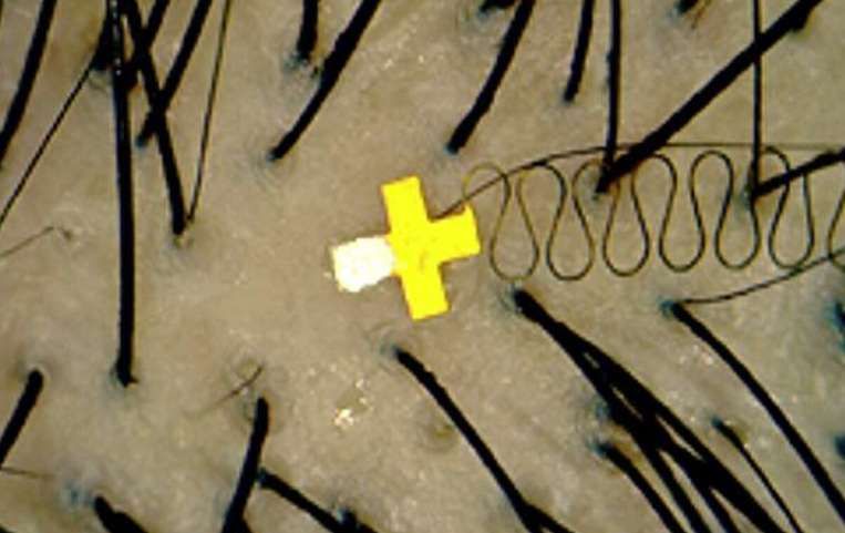 毛囊級傳感器:研究員研發可運動無感佩戴的AR控制傳感器 第2張 毛囊級傳感器:研究員研發可運動無感佩戴的AR控制傳感器 第2張