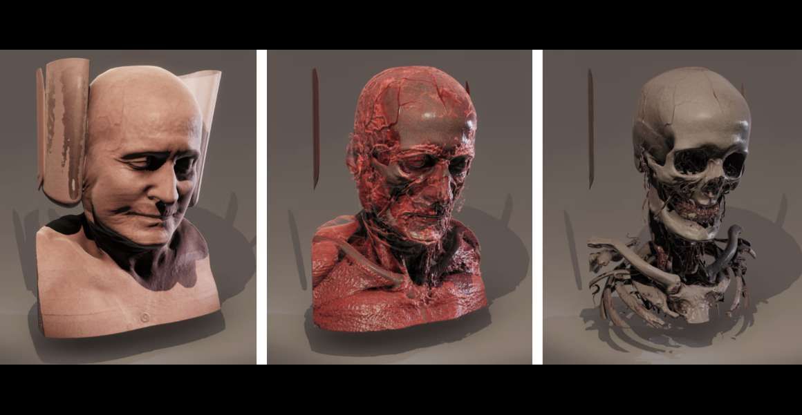 Specto Medical基于Vision Pro+Unity構建XR醫學影像平臺 第2張 Specto Medical基于Vision Pro+Unity構建XR醫學影像平臺 第2張